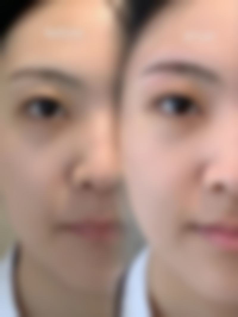 四、周口红美医疗美容医院特色项目