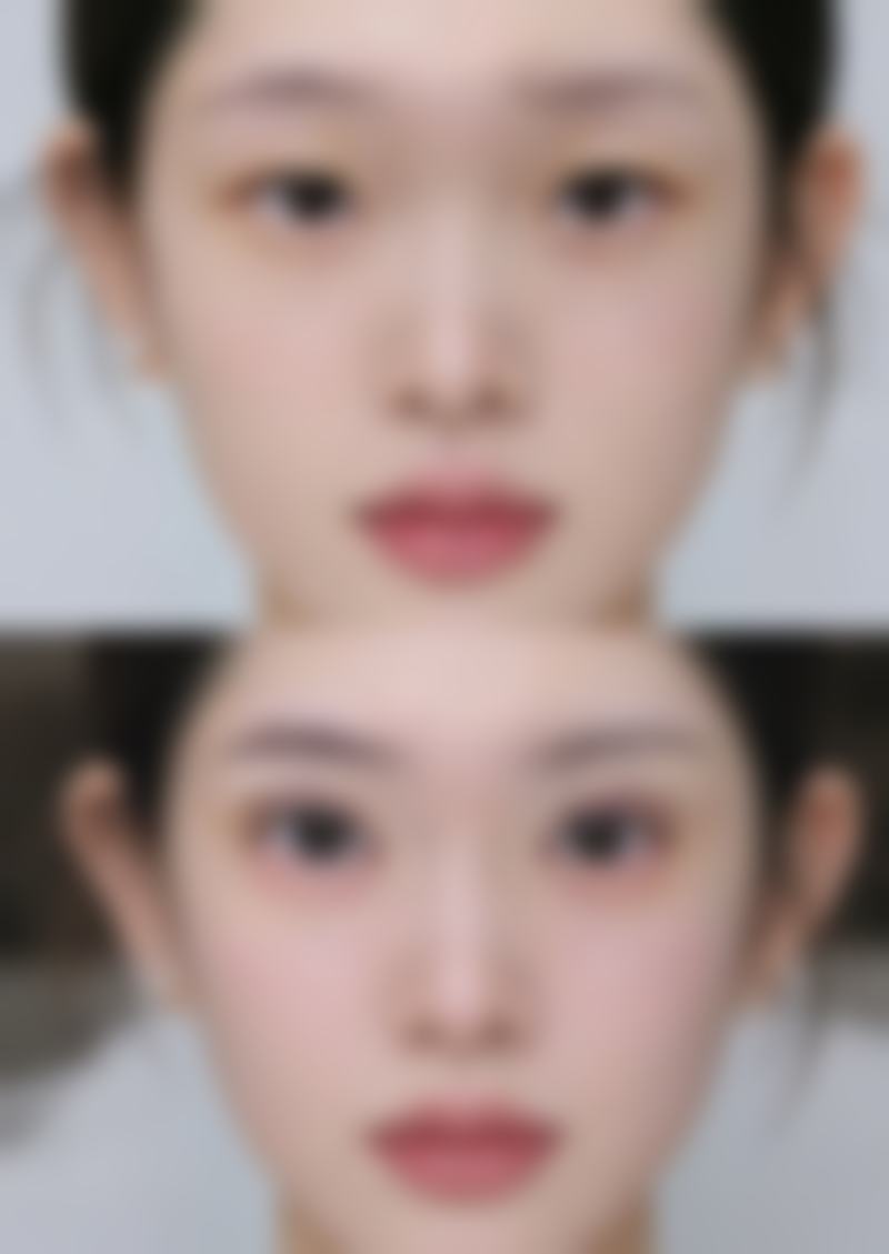 五、玉溪市人民医院(口腔颌面整形外科)价格表