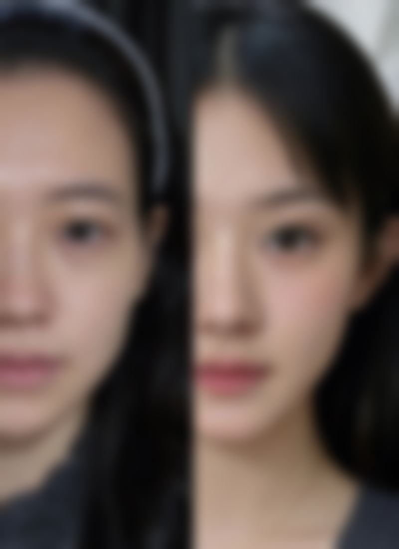 五、双眼皮用抹去疤膏吗?术后修复注意事项