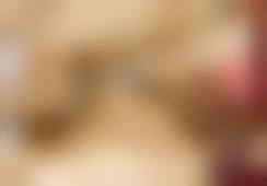 二、莲湖区宋蔚医生眼部整形收费情况