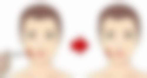 二、冬天做双眼皮的优势与难点