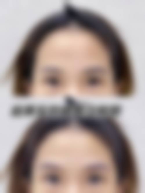 二、深圳木斯医疗美容诊所怎么样？