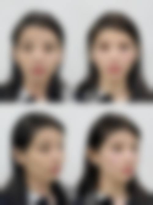 八、深圳木斯医疗美容诊所真实的患者评价