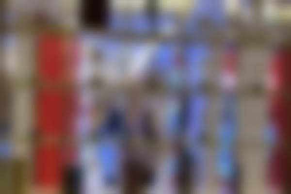 五、莲湖区宋蔚医生眼部整形成功实例