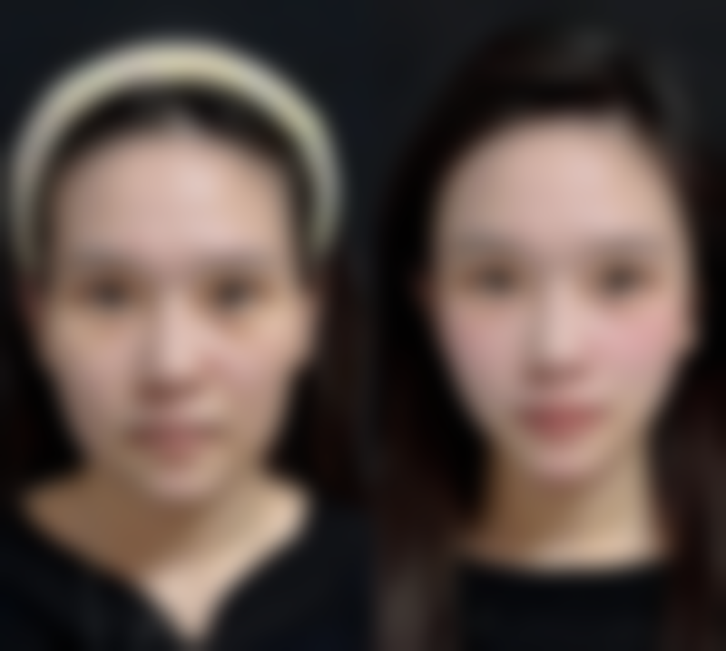 二、普宁安淇医院医疗美容怎么样？