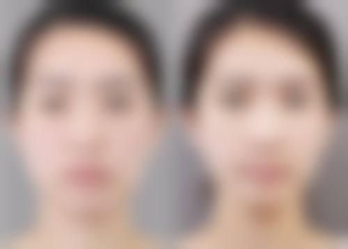 三、张渝宁技术优势