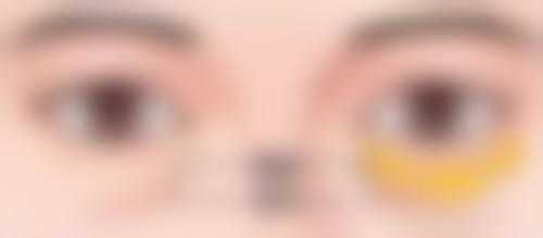 四、术后饮食“温和”原则下吃桃的注意事项