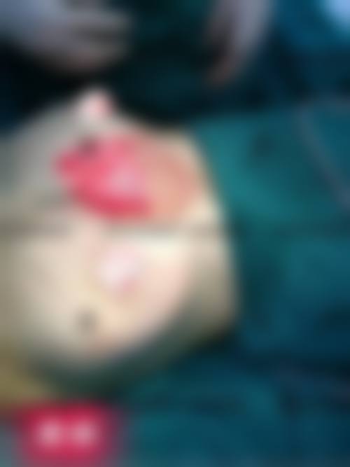 七、沈阳铂木整形医院预约方式