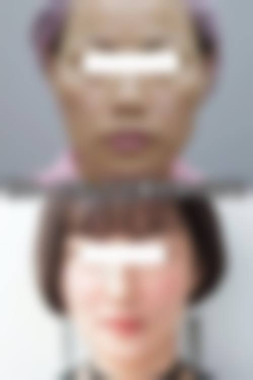 三、重庆妮威整形美容院诊疗项目有哪些?