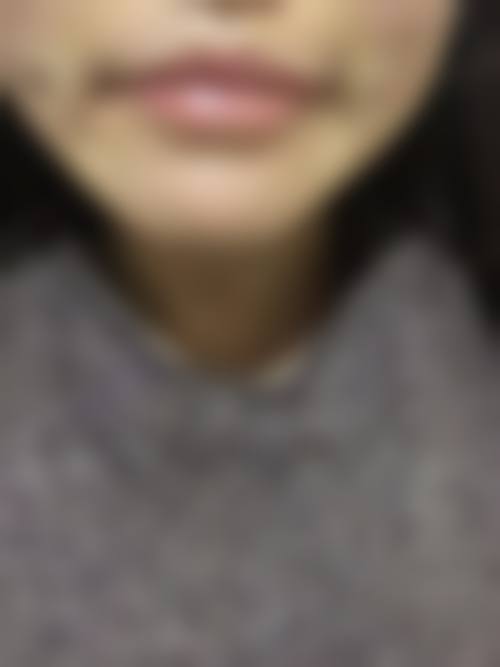 八、河北邢台遇见美整形真实的患者评价