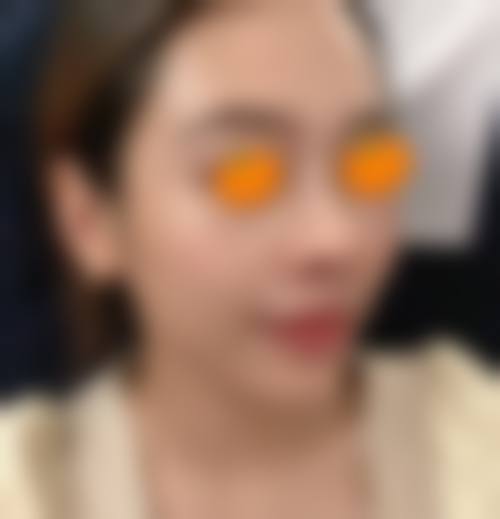 七、河北邢台遇见美整形预约方式