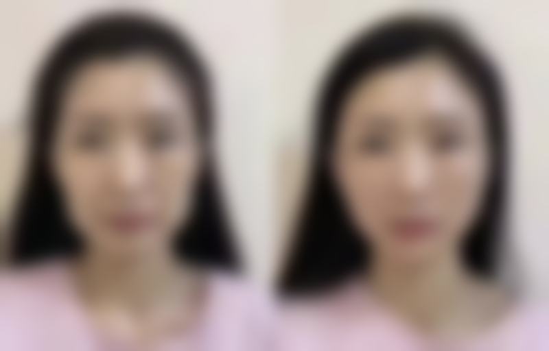 四、重庆妮威整形美容院特色项目