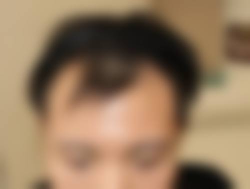 八、韩城联禾丽致医疗美容诊所真实的患者评价