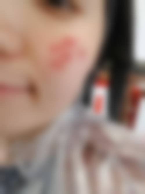 八、锦州博美医疗美容门诊部真实的患者评价