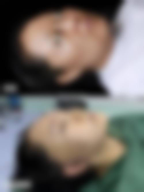 四、韩城联禾丽致医疗美容诊所特色项目