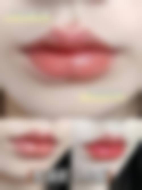 六、南宁诗丽堂医疗美容诊所价格表