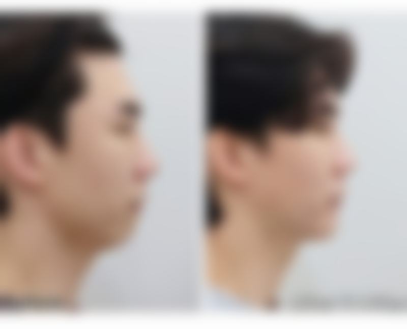 六、联合治疗的个性化方案