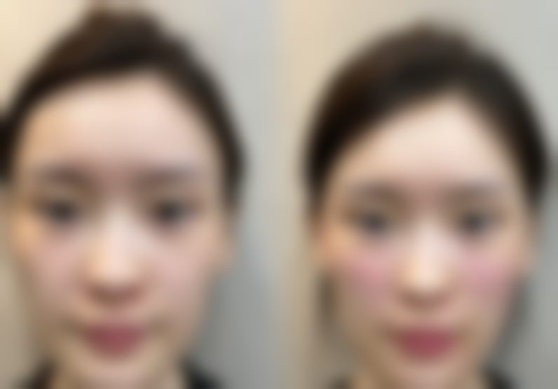 四、金哉勋收费价格表