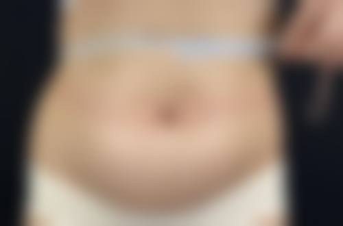 一、Eve整形外科正规吗？