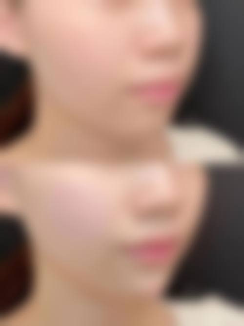 二、西安莲湖瑞丽医院医学美容怎么样？