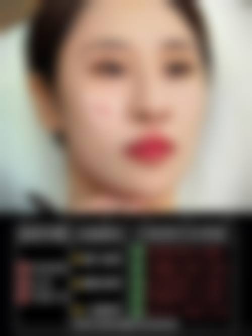 六、Eve整形外科价格表