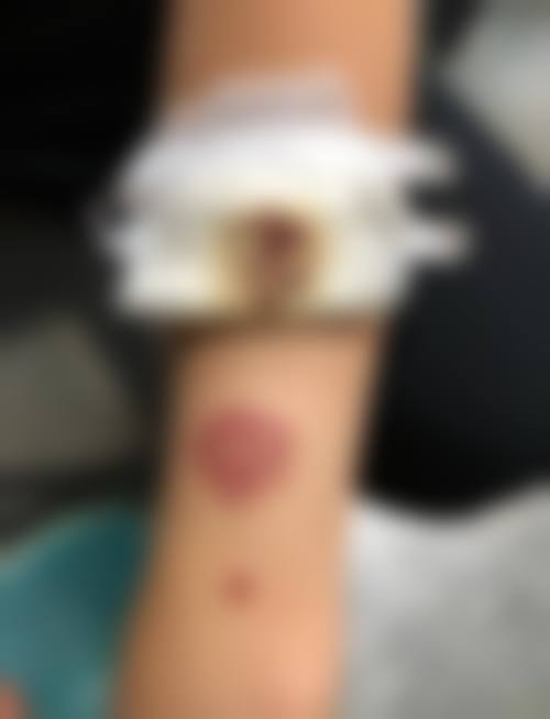 五、西安莲湖瑞丽医院医学美容价格表