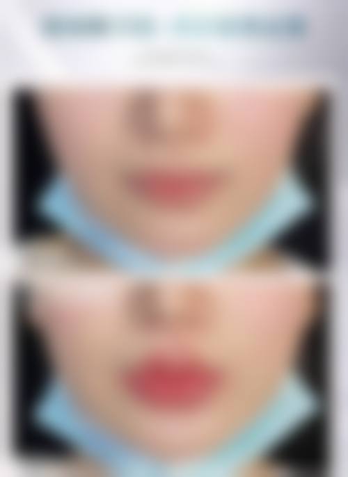 九、Eve整形外科真实的患者评价