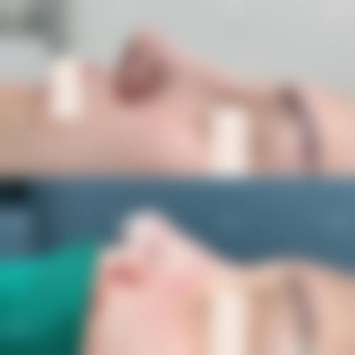 四、郑州天美医疗美容门诊部特色项目