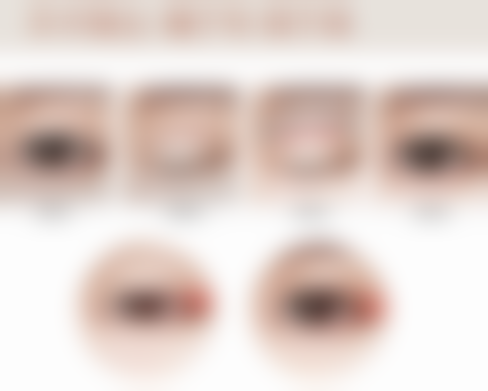 五、疤痕疙瘩的其他治疗方式及联合治疗建议