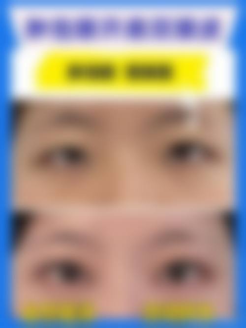 九、江西智美医疗美容门诊部真实的患者评价