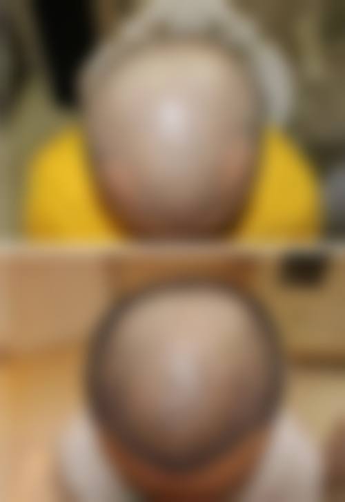 四、湖北荆州汀恩整形医院特色项目