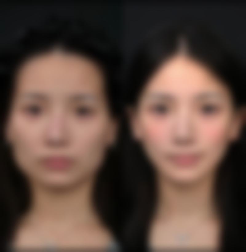 六、高峡真实的患者评价