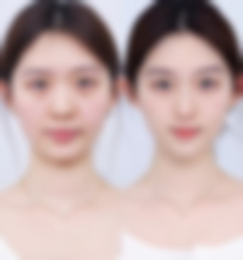 二、叶丽琴擅长项目