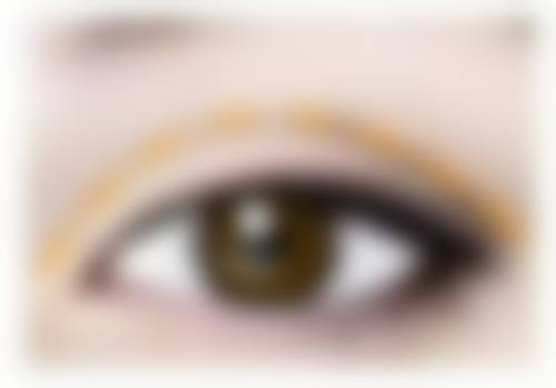 一、激光治疤痕的基本原理