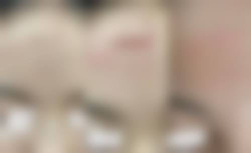 六、成都暄妍医疗美容门诊部价格表