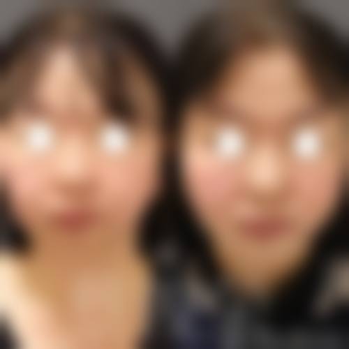 二、成都暄妍医疗美容门诊部怎么样？