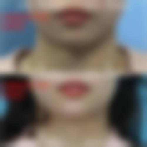 九、成都暄妍医疗美容门诊部真实的患者评价