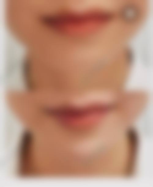 四、成都暄妍医疗美容门诊部特色项目