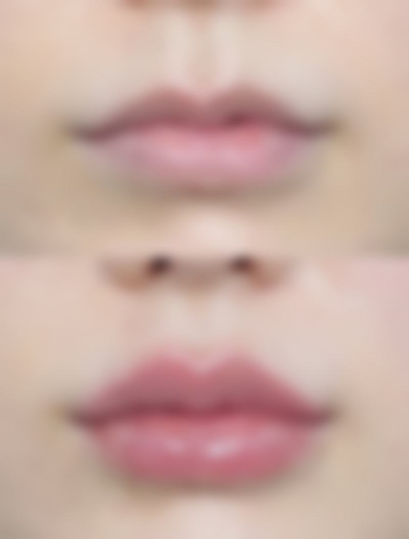 五、怎么去掉黑眼圈眼袋的秘诀简单之注意事项