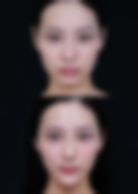 六、韩国T.O.P整形外科价格表