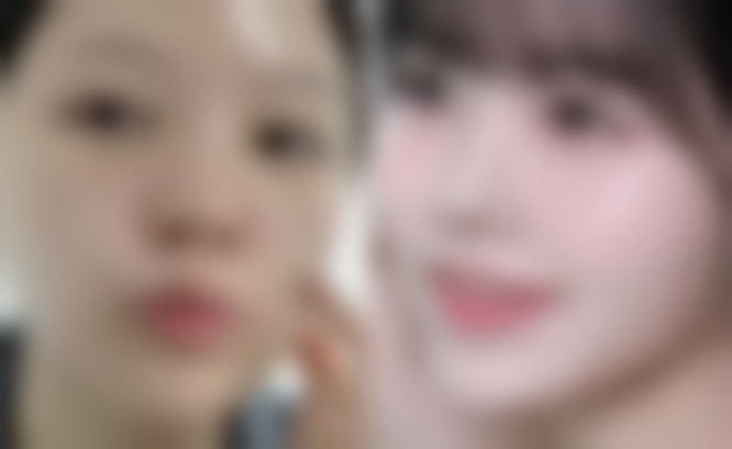 五、治疗注意事项