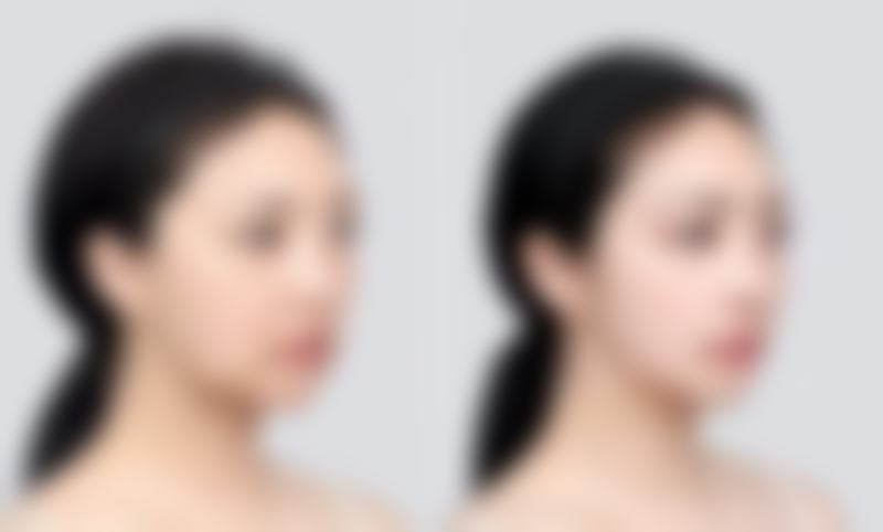 二、韩国T.O.P整形外科怎么样？