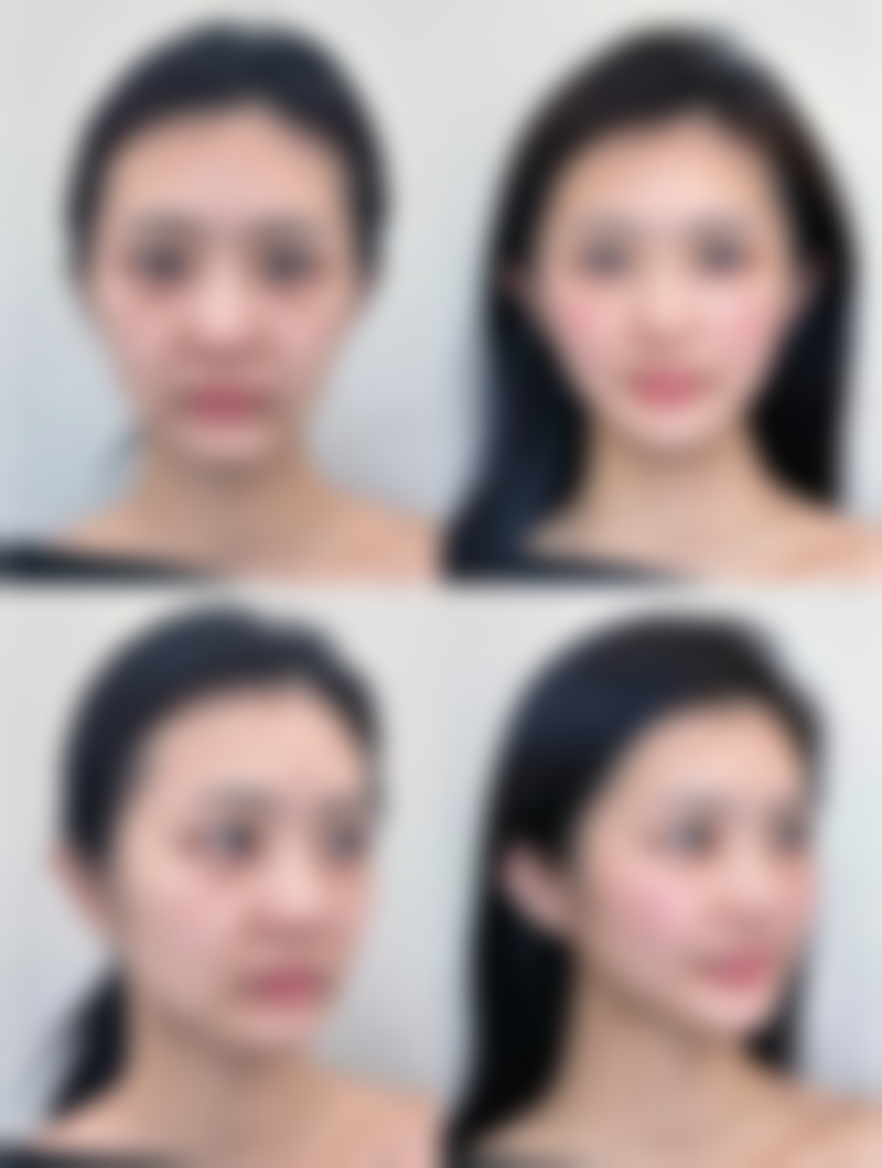 二、治疗前的评估