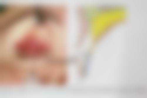 一、50多岁做双眼皮的可行性