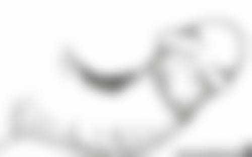 一、双眼皮割太窄的成因分析