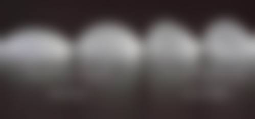 八、杭州阿薇医疗美容诊所真实的患者评价