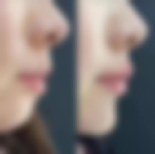 三、杭州阿薇医疗美容诊所诊疗项目有哪些?