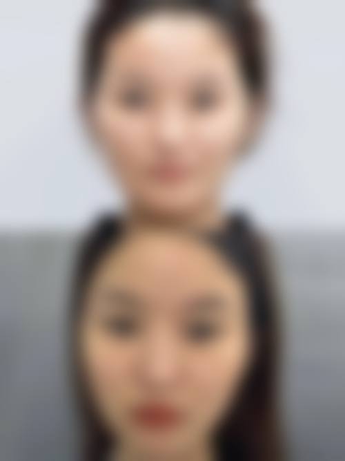 九、武汉奥黛丽整形医院真实的患者评价