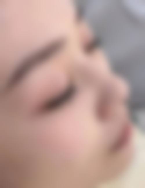 九、武汉铂恩医疗美容门诊部真实的患者评价