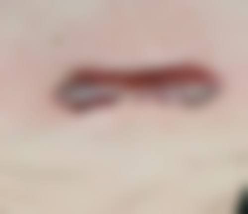 五、郭红磊怎么预约?